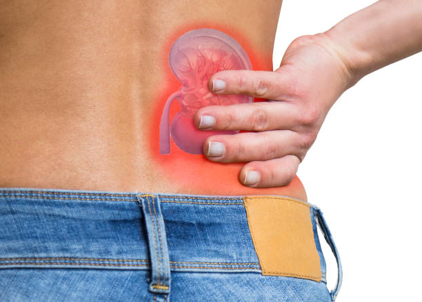 Kidney and low back pain